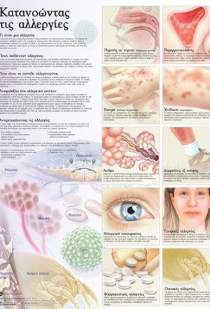 Ανατομικός χάρτης: κατανοώντας τις αλλεργιες